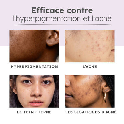 Coffret Renaissance Éclat 5-en-1